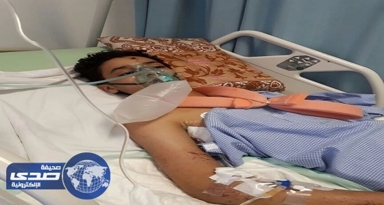 أطباء مستشفى عسير ينهون معاناة مواطن بعملية جراحية استمرت 9 ساعات