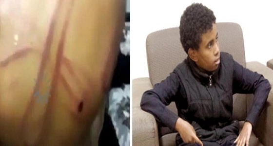 تفاصيل جديدة عن تعذيب طفل " تبوك ".. عمه عنفه بسلك واعتاد الاعتداء عليه وشقيقه بالضرب