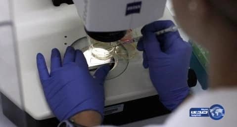 دراسة بحثية : تطور علمي جديد قد ينهي معاناة مرضى الكُلى إلى الأبد