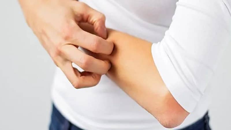 الحكة في القدمين واليدين أحد أعراض الكبد الدهني