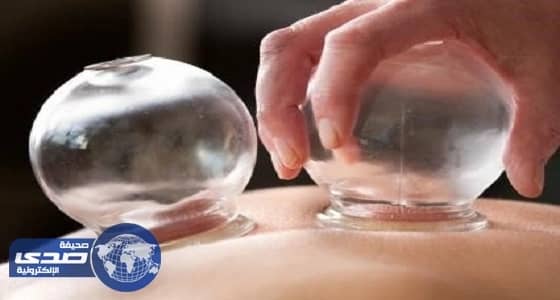 مختصون يحذرون من خطورة الحجامة