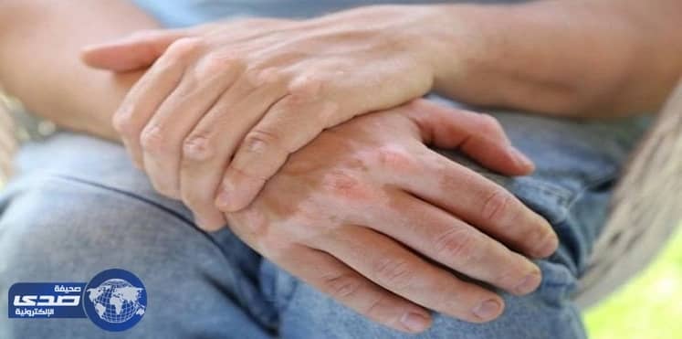 أمريكية تنتصر علي مرضها بتحويله للوحة فنية