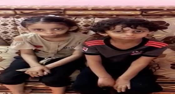 نجاح عملية جراحية نادرة لإنهاء معاناة طفلين في جازان