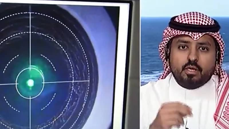 "استشاري": كثرة مشاكل النظر المتكررة تدل على وجود مشكلة في القرنية المخروطية (فيديو)