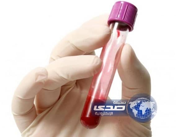 فحص للدم يحدد كم تبقى من العمر