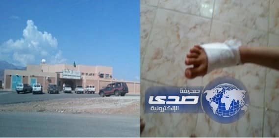 كوفي شوب مدرسة الطلاليع للبنات يتسبب بحروق طالبة