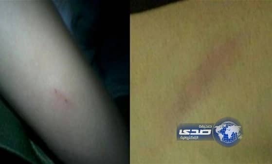 طالبة بابتدائية و متوسطة الطلاليع تتعرض للاعتداء والضرب المبرح 