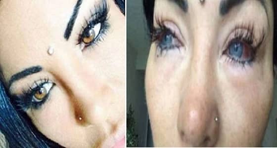 بالصور.. نهاية مأساوية لعارضة أزياء حاولت تغيير لون عينيها