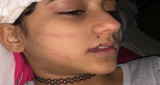 فيديو.. والد طفلة السوشيال ميديا يكشف تفاصيل هجوم نمر مفترس عليها