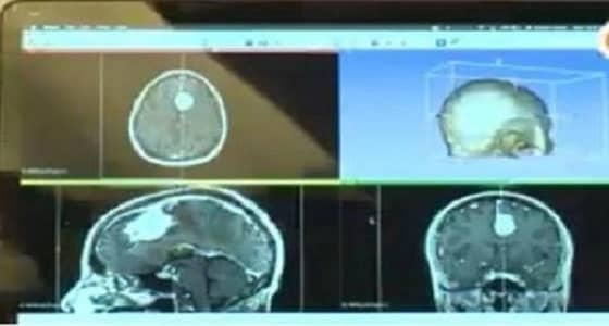طبيب يستخدم التقنية في طباعة أعضاء من جسم الإنسان لتطوير العمليات الجراحية