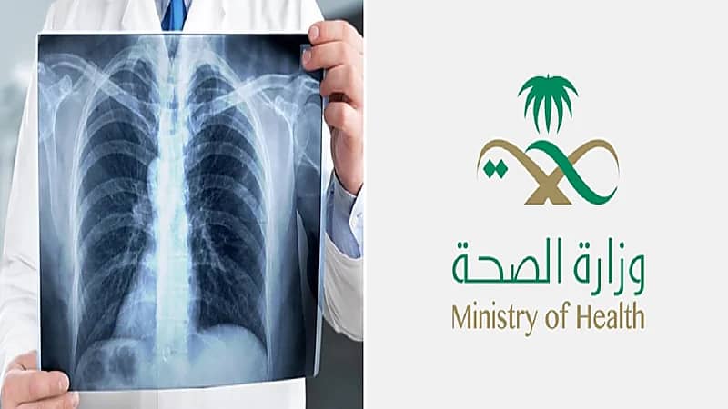 وزارة الصحة توجه نصائح لمرضى السل