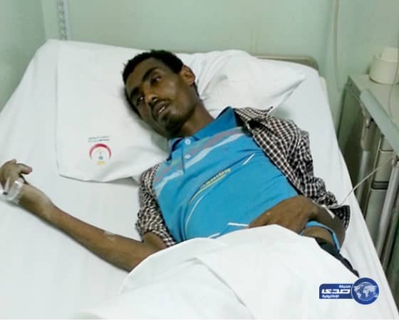 عقرب سام يُلدع عامل في قدمه