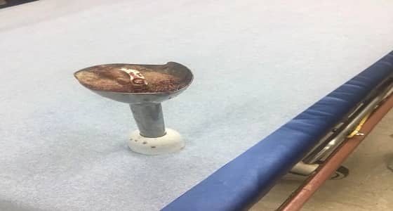 إنقاذ سيدة بعد احتجاز إصبعها بـ " فرامة لحم " في المدينة