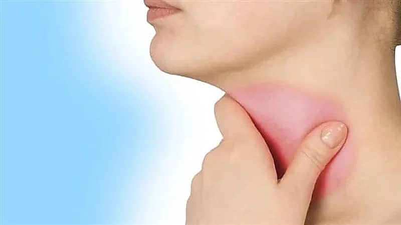 كيفية علاج بحة الصوت بالمنزل