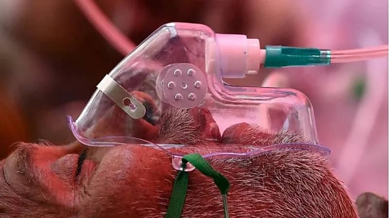 بالفيديو.. استشاري: نسبة الوفاة بعد الإصابة بالفطر الأسود تصل إلى 54%