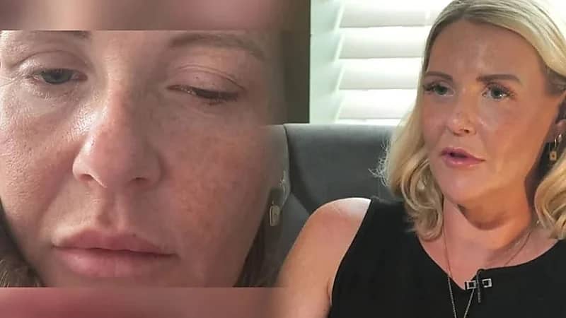 حقن تجميل غير مرخصة تصيب النساء بالتسمم في بريطانيا