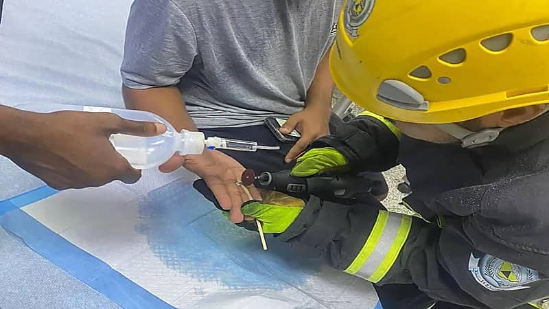 الدفاع المدني يحرر إصبع شخص علق في قطعة معدنية