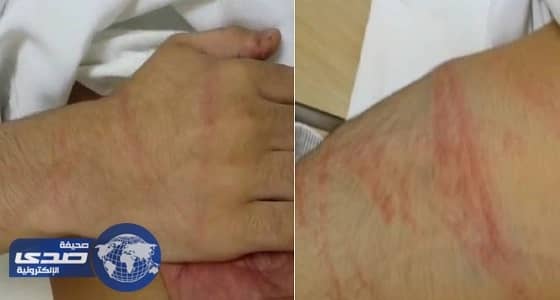 بالفيديو.. تعذيب وضرب مبرح لمواطن داخل مركز تأهيل في وداي الدواسر