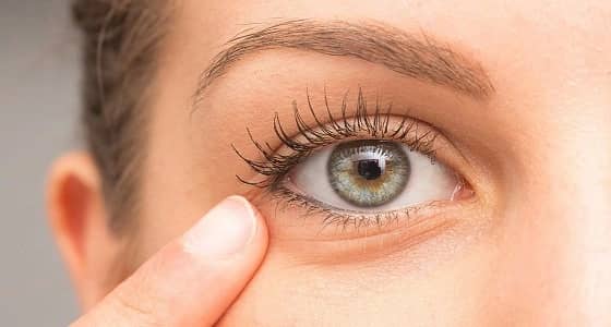 نصائح هامة للتخلص من انتفاخ العيون