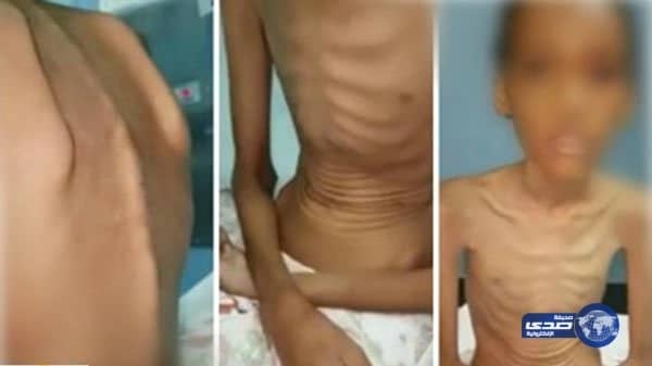 والدة أطفال خيبر تنفي تعذيبهم وحرمانهم من الأكل ..وتؤكد إضرابهم عن الطعام من تلقاء نفسهم