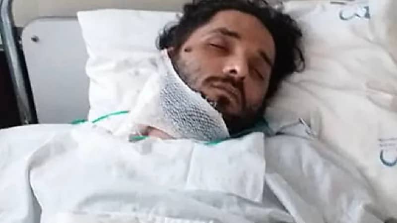 شاب يروي جرائم الباسيج بإيران بعد إصابته برصاصة اخترقت أذنه