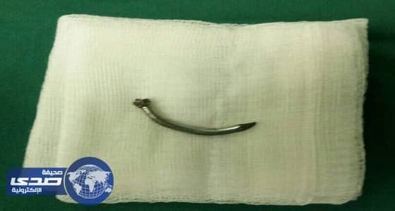 استخراج مسمار من عين مصاب بالمستشفى السعودي الألماني بعسير