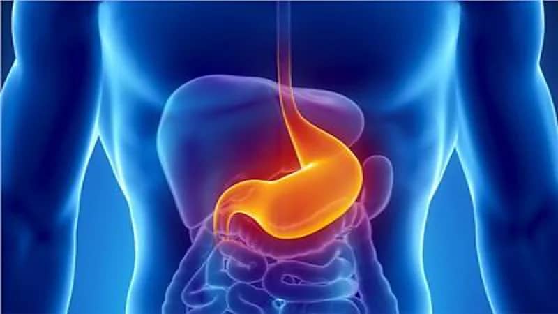 مشروبات وأطعمة تؤدي إلى ارتباك المعدة