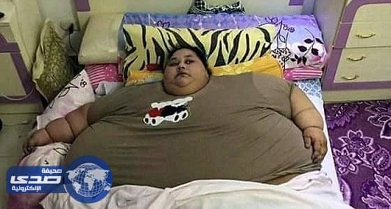 مستشفي أبو ظبي تستعد لاستقبال المصرية إيمان لاستكمال علاجها