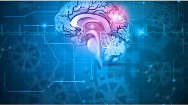 عدوى فيروسية "نائمة" قد تؤدي لسكتة دماغية!