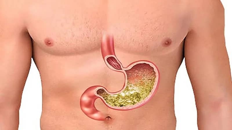 الذيابي: عمليات السمنة تعد من أسباب نقص فيتامين ب 12