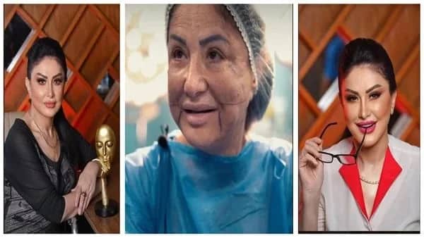 وفاء سالم بإطلالة عشرينية بعد تعرضها لخطأ طبي شوه وجهها