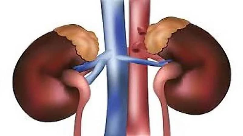 استشاري يكشف عن السبب الرئيسي لتليف الكليتين 