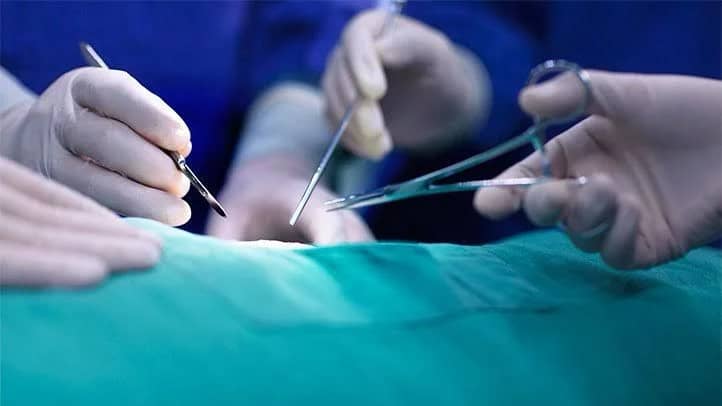 رجل أمريكي يقاضي مركز طبي بسبب فشل الجراحين بإجراء عملية الزائدة