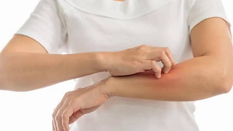 مختص: التوتر قد يتسبب في الحكة والطفح الجلدي