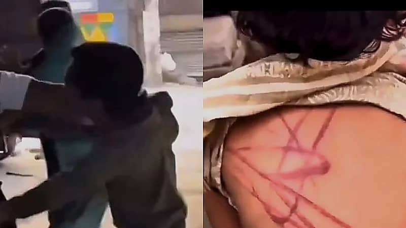 مارة يضربون ويجرون والدًا في الشارع بعد اكتشاف تعذيبه لطفلته  ..  فيديو