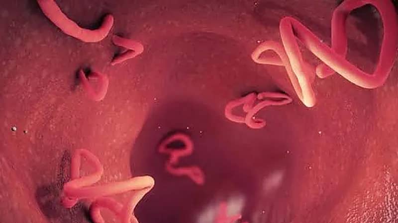 ‎علامات تحذيرية خطيرة تدل على الإصابة بالديدان الخطافية والشريطية