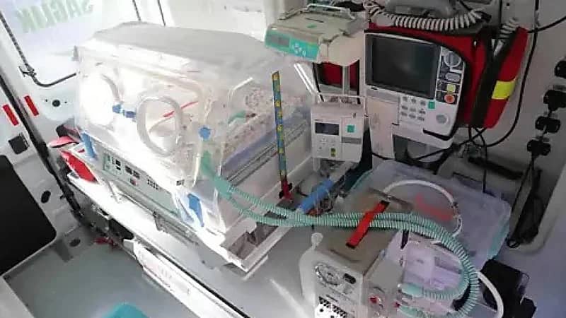 ولادة نادرة لطفل بجلد سمكة