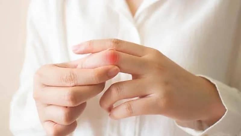 الكشف عن أبرز أسباب انتفاخ اليدين عند الاستيقاظ