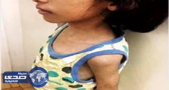 العمل تتابع حالة أطفال طردهم والدهم إلى الشارع