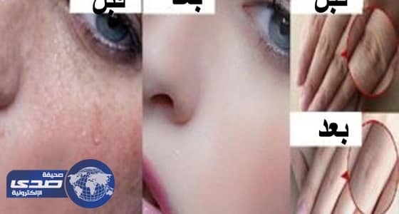 ماسك ليلي هائل لبشرة مشرقة