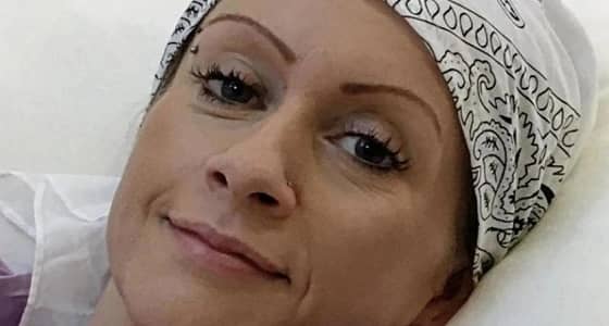 بريطانية تجمع 80 ألف جنيه إسترليني لعلاج طليقة زوجها