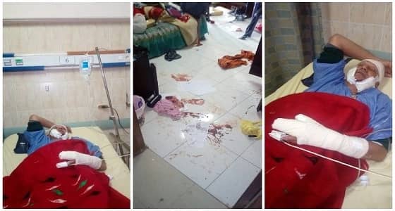 مخرج مصري يتعرض لمحاولة قتل بشعة على يد مجهولين