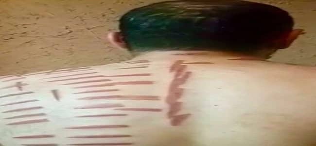 الصحة تحيل مدعي العلاج بالكي في القصيم للتحقيق