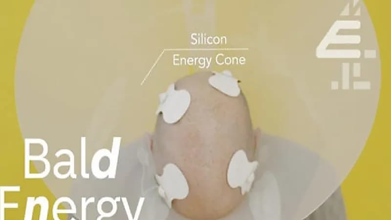 حقيقة الأخبار المتداولة بشأن توليد الكهرباء من " صلعة الرجال"