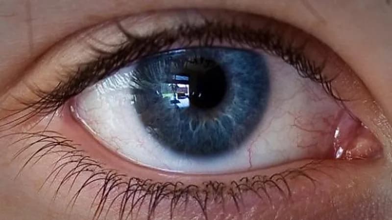 أطباء يتوصلون لطريقة جديدة يمكن من خلالها استعادة البصر