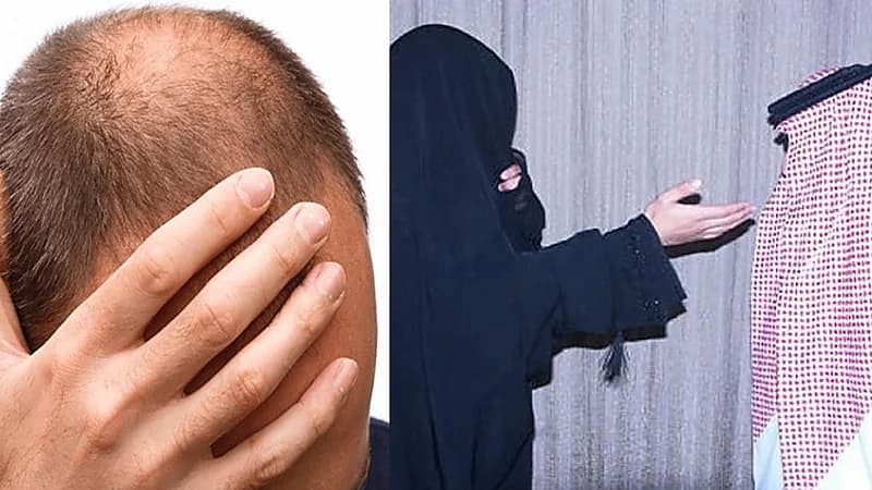 مواطنة تطلب الطلاق بعد أول يوم زواج: "اكتشفت إنه أصلع"