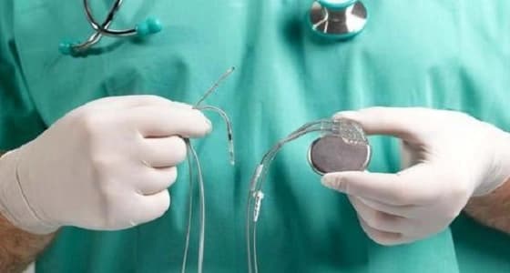 اختراعات توصل لها الإنسان دون قصد