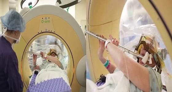 بالفيديو والصور.. سيدة تجري عملية جراحية في المخ وهي تعزف المزمار
