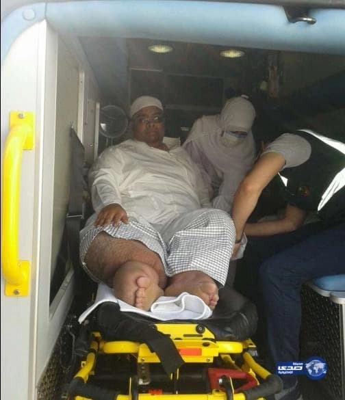 مدينة الملك عبد الله الطبية تحقق أمنية صاحب داء"الفيل"في العلاج