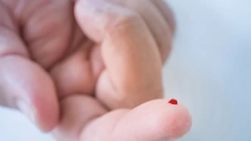 تطوير اختبار لـ"كورونا " بوخز الإصبع